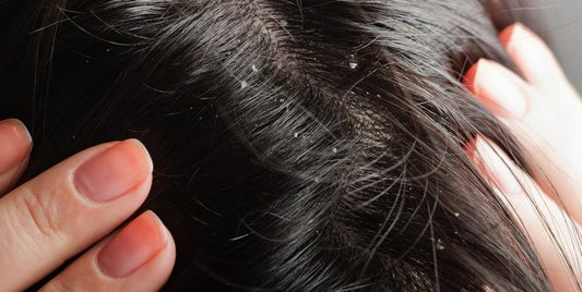 Masque antipelliculaire maison